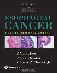 Esophageal Cancer: Principles and Practice