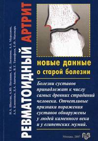 Ревматоидный артрит - новые данные о старой болезни