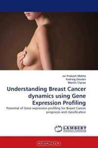 Understanding Breast Cancer dynamics using Gene Expression Profiling: Potential of Gene expression profiling for Breast Cancer prognosis and classification