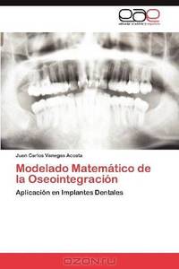 Modelado Matematico de la Oseointegracion: Aplicacion en Implantes Dentales (Spanish Edition)