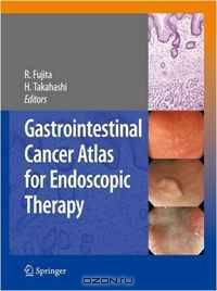 Gastrointestinal Cancer Atlas for Endoscopic Therapy