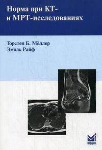 Норма при КТ- и МРТ-исследованиях