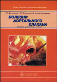 Болезни аортального клапана (пер.). Функция, диагностика, лечение