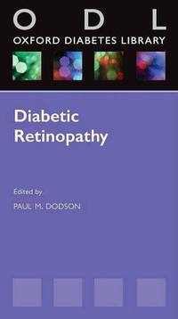 Diabetic Retinopathy: From Screening to Treatment