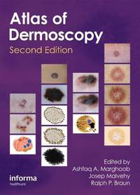 An Atlas of Dermoscopy