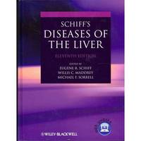 Schiff's Diseases of the Liver