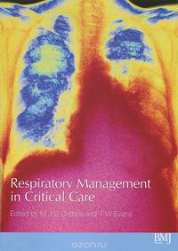 Respiratory Management in Critical Care