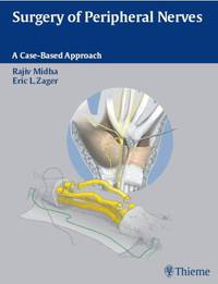 Surgery of Peripheral Nerves