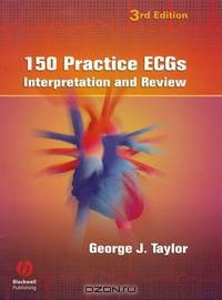 150 Practice ECGs