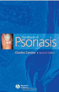 Handbook of Psoriasis