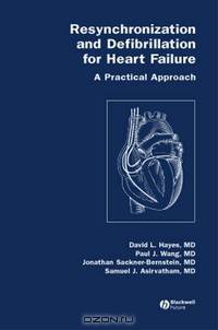 Resynchronization and Defibrillation for Heart Failure