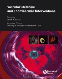 Vascular Medicine and Endovascular Interventions