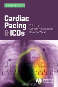 Cardiac Pacing and ICDs
