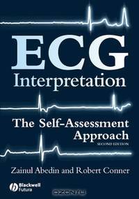 ECG Interpretation