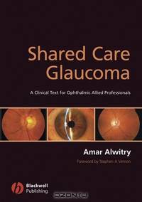 Shared Care Glaucoma