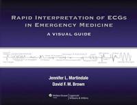 Rapid Interpretation of ECGs in Emergency Medicine