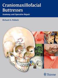 Craniomaxillofacial Buttresses: Anatomy and Operative Repair
