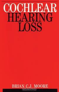 Cochlear Hearing Loss