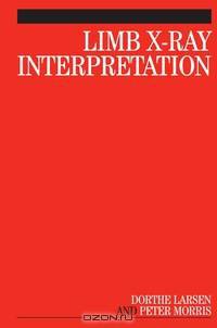 Limb X–Ray Interpretation