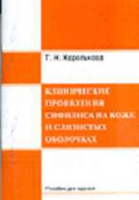 Клинические проявления сифилиса на коже и слизистых оболочках