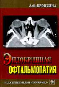 Эндокринная офтальмопатия