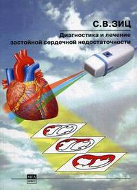 Диагностика и лечение застойной сердечной недостаточности (2-е издание)