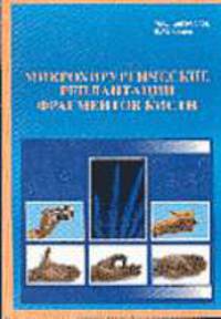 Микрохирургические реплантации фрагментов кисти