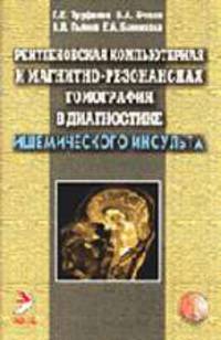 Рентгеновская компьютерная и магнитно-резонансная томография в диагностике ишемического инсульта.