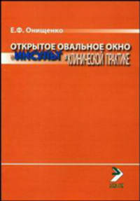 Открытое овальное окно и инсульт в клинической практике.
