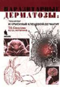 Паразитарные дерматозы. Чесотка и крысиный клещевой дерматит