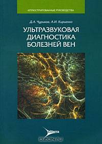 Ультразвуковая диагностика болезней вен