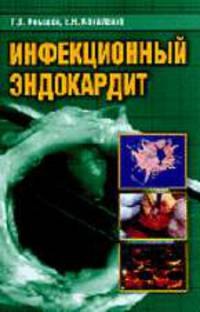 Инфекционный эндокардит
