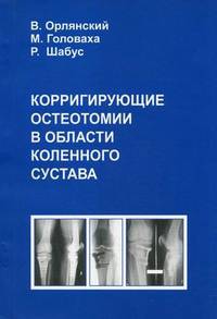 Корригирующие остеотомии в области коленного сустава
