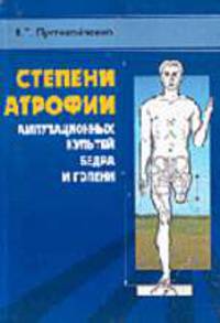 Степени атрофии ампутационных культей бедра и голени: медико-статистическое исследование
