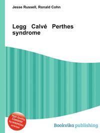 Legg Calve Perthes syndrome