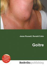 Goitre
