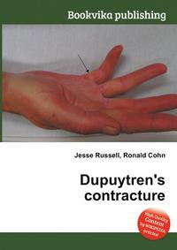 Dupuytren's contracture