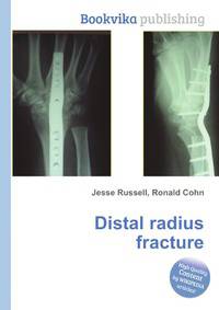 Distal radius fracture