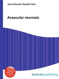 Avascular necrosis