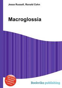 Macroglossia