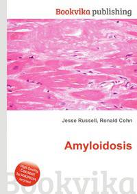 Amyloidosis