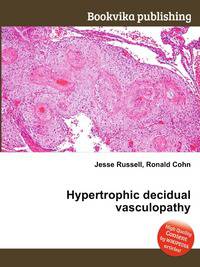 Hypertrophic decidual vasculopathy