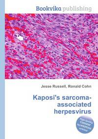 Kaposi's sarcoma-associated herpesvirus