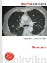 Metastasis