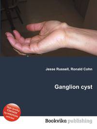 Ganglion cyst