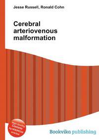Cerebral arteriovenous malformation