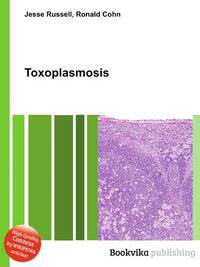 Toxoplasmosis