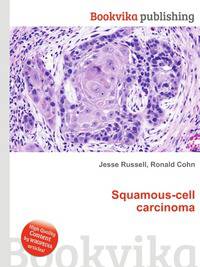Squamous-cell carcinoma