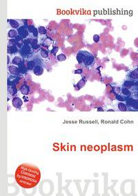 Skin neoplasm
