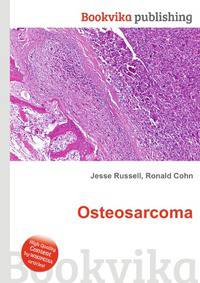 Osteosarcoma